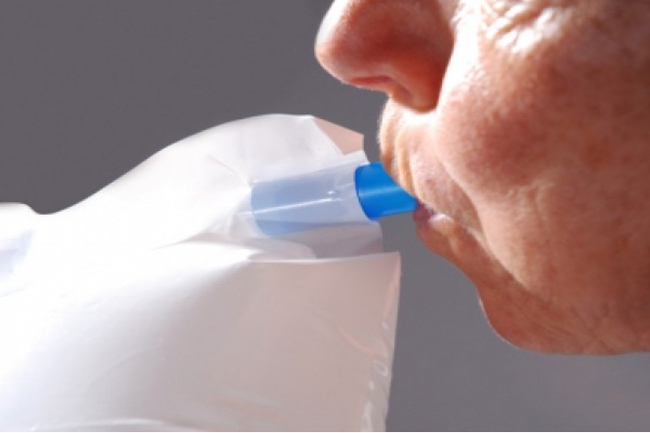 breath test lattosio